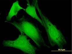 DBC1, Mouse anti-Human, Polyclonal Antibody, Abnova 50&mu;g; Unconjugated:Antibodies,