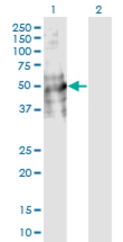 DDC, Mouse anti-Human, Clone: 8E8, Abnova 100&mu;g; Unconjugated:Antibodies,