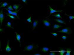 DIAPH1, Mouse anti-Human, Polyclonal Antibody, Abnova 50&mu;g; Unconjugated:Antibodies,
