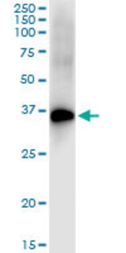 DLX4, Rabbit anti-Human, Polyclonal Antibody, Abnova 100&mu;L; Unconjugated:Antibodies,