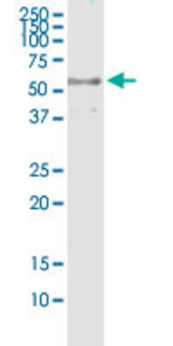 DYNC1LI2, Rabbit anti-Human, Polyclonal Antibody, Abnova 100&mu;L; Unconjugated:Antibodies,