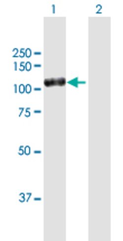 DPP4, Mouse anti-Human, Polyclonal Antibody, Abnova 50&mu;g; Unconjugated:Antibodies,