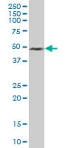 ELAVL3, Mouse anti-Human, Polyclonal Antibody, Abnova 50&mu;g; Unconjugated:Antibodies,