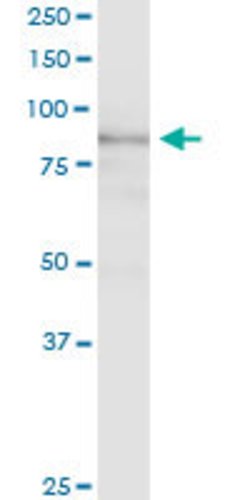 EPB41L1, Rabbit anti-Human, Polyclonal Antibody, Abnova 100&mu;g; Unconjugated:Antibodies,
