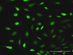EPB41L1, Rabbit anti-Human, Polyclonal Antibody, Abnova 100&mu;g; Unconjugated:Antibodies,