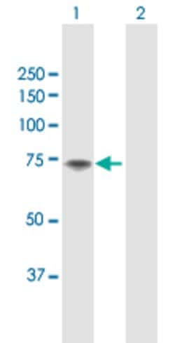 F11, Rabbit anti-Human, Polyclonal Antibody, Abnova 100&mu;L; Unconjugated:Antibodies,