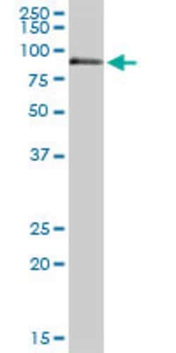 F11, Rabbit anti-Human, Polyclonal Antibody, Abnova 100&mu;L; Unconjugated:Antibodies,