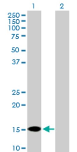 FABP7, Mouse anti-Human, Polyclonal Antibody, Abnova 50 &mu;g | Buy Online | Abnova | Fisher Scientific