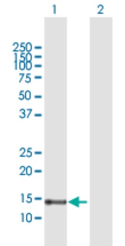 FABP7, Rabbit anti-Human, Polyclonal Antibody, Abnova 100&mu;g; Unconjugated:Antibodies,