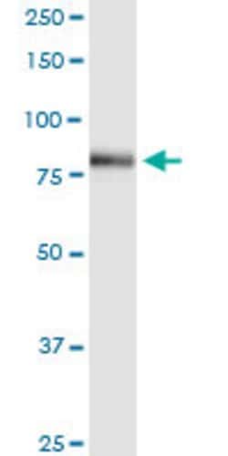 ACSL3, Rabbit anti-Human, Polyclonal Antibody, Abnova 100&mu;L; Unconjugated:Antibodies,