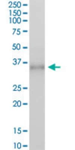 FCGR2A, Mouse anti-Human, Polyclonal Antibody, Abnova 50&mu;g; Unconjugated:Anticuerpos