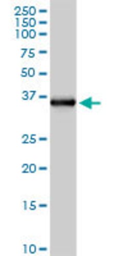 FCN2, Rabbit anti-Human, Polyclonal Antibody, Abnova 100&mu;g; Unconjugated:Antibodies,