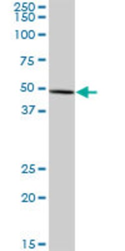 FDXR, Mouse anti-Human, Polyclonal Antibody, Abnova™