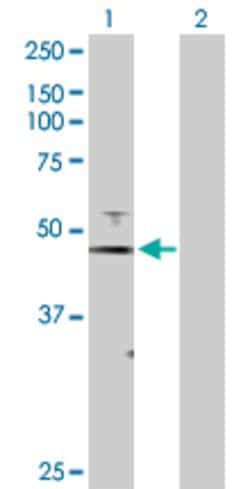 FOXJ1, Rabbit anti-Human, Polyclonal Antibody, Abnova 100&mu;g; Unconjugated:Antibodies,