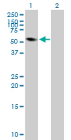 FRK, Mouse anti-Human, Polyclonal Antibody, Abnova™