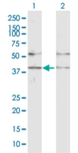 GABPB1, Rabbit anti-Human, Polyclonal Antibody, Abnova 100&mu;g; Unconjugated:Antibodies,
