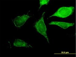 GCDH, Mouse anti-Human, Polyclonal Antibody, Abnova™