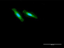 GCDH, Rabbit anti-Human, Polyclonal Antibody, Abnova 100&mu;g; Unconjugated:Antibodies,