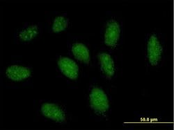 GCH1, Mouse anti-Human, Polyclonal Antibody, Abnova 50&mu;g; Unconjugated:Antibodies,