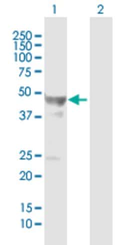 GFAP, Mouse anti-Human, Polyclonal Antibody, Abnova™