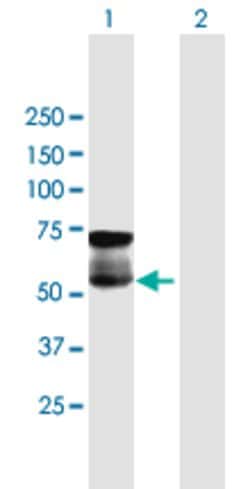 GGT1, Mouse anti-Human, Polyclonal Antibody, Abnova 50&mu;g; Unconjugated:Antibodies,