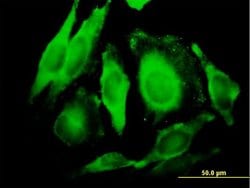 GGT1, Mouse anti-Human, Polyclonal Antibody, Abnova 50&mu;g; Unconjugated:Antibodies,