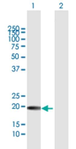GH1, Rabbit anti-Human, Polyclonal Antibody, Abnova 100&mu;L; Unconjugated:Antibodies,