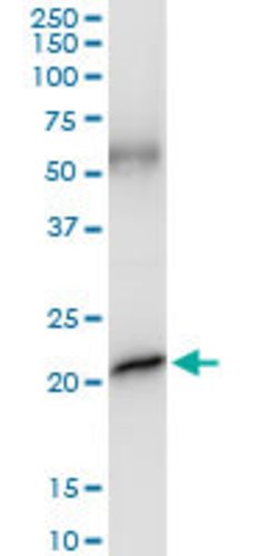 GH1, Rabbit anti-Human, Polyclonal Antibody, Abnova 100&mu;L; Unconjugated:Antibodies,
