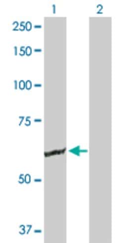 GK2, Mouse anti-Human, Polyclonal Antibody, Abnova™