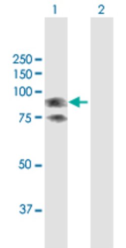 GLB1, Rabbit anti-Human, Polyclonal Antibody, Abnova 100&mu;L; Unconjugated:Antibodies,