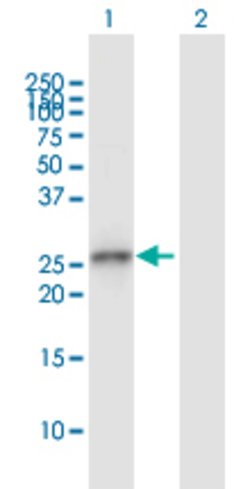 GCLM, Rabbit anti-Human, Polyclonal Antibody, Abnova 100&mu;L; Unconjugated:Antibodies,