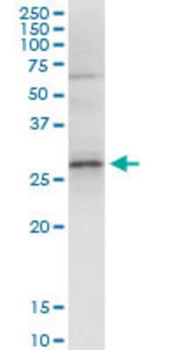 GCLM, Rabbit anti-Human, Polyclonal Antibody, Abnova 100&mu;L; Unconjugated:Antibodies,