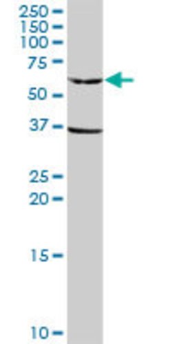 GPI, Rabbit anti-Human, Polyclonal Antibody, Abnova 100&mu;L; Unconjugated:Antibodies,