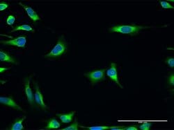 PDIA3, Rabbit anti-Human, Polyclonal Antibody, Abnova 100&mu;g; Unconjugated:Antibodies,