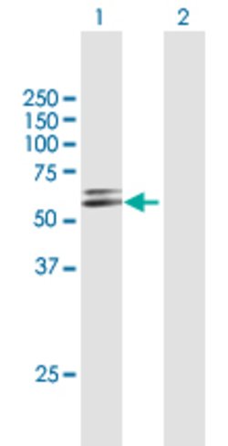 GSR, Mouse anti-Human, Polyclonal Antibody, Abnova 50&mu;g; Unconjugated:Antibodies,