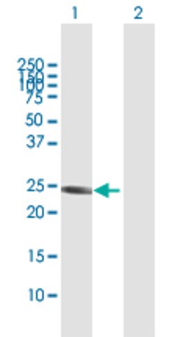 GSTA1, Rabbit anti-Human, Polyclonal Antibody, Abnova 100&mu;L; Unconjugated:Antibodies,