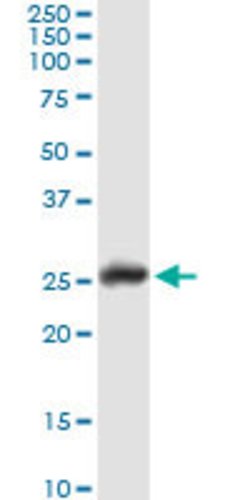 GSTA1, Rabbit anti-Human, Polyclonal Antibody, Abnova 100&mu;L; Unconjugated:Antibodies,