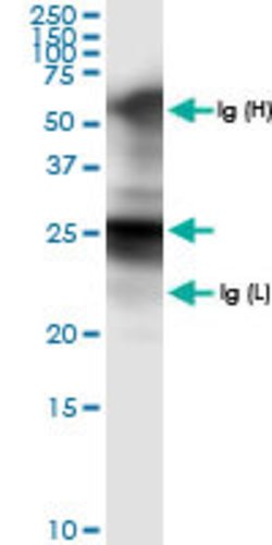 GSTA1, Rabbit anti-Human, Polyclonal Antibody, Abnova 100&mu;L; Unconjugated:Antibodies,