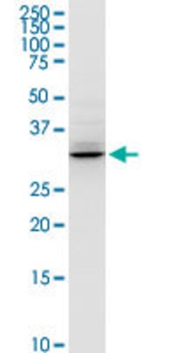 HADH, Rabbit anti-Human, Polyclonal Antibody, Abnova 100&mu;L; Unconjugated:Antibodies,