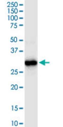 HADH, Rabbit anti-Human, Polyclonal Antibody, Abnova 100&mu;L; Unconjugated:Antibodies,