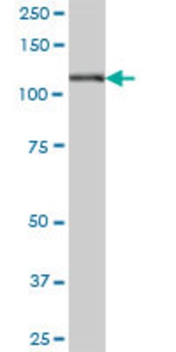 HK1, Mouse anti-Human, Polyclonal Antibody, Abnova 50&mu;g; Unconjugated:Antibodies,