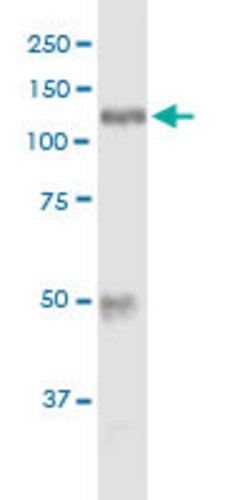 HK1, Mouse anti-Human, Polyclonal Antibody, Abnova 50&mu;g; Unconjugated:Antibodies,