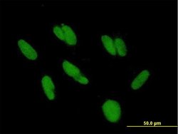 ZBTB48, Mouse anti-Human, Polyclonal Antibody, Abnova 50&mu;g; Unconjugated:Antibodies,