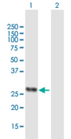 HLA-DMA, Mouse anti-Human, Polyclonal Antibody, Abnova 50&mu;g; Unconjugated:Antibodies,