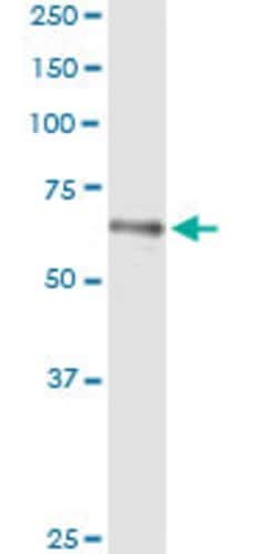 HLX, Mouse anti-Human, Clone: 1B9, Abnova 100&mu;g; Unconjugated:Antibodies,