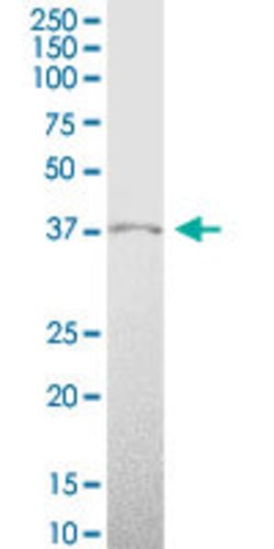 HMX1, Mouse anti-Human, Polyclonal Antibody, Abnova 50 &mu;g | Buy Online | Abnova | Fisher Scientific
