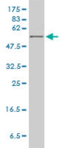 HPRT1, Mouse anti-Human, Clone: 4C3-G8, Abnova 100&mu;g; Unconjugated:Antibodies,