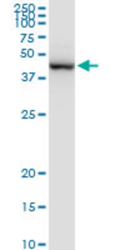 PRMT2, Rabbit anti-Human, Polyclonal Antibody, Abnova 100&mu;g; Unconjugated:Antibodies,