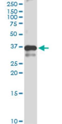 DNAJB2, Rabbit anti-Human, Polyclonal Antibody, Abnova 100&mu;L; Unconjugated:Antibodies,