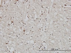 DNAJB2, Mouse anti-Human, Clone: 2C9, Abnova 100&mu;g; Unconjugated:Antibodies,